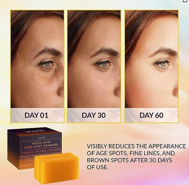 VALITIC Kojic Acid Dark Spot Remover Soap